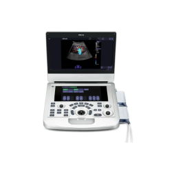 EDAN Acclarix AX3 Sistema de Ultrasonido de Diagnóstico  Acclarix AX3 Sistema de Ultrasonido de Diagnóstico, AX3, equipo ultrasonido